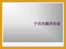 子宫内膜异位症