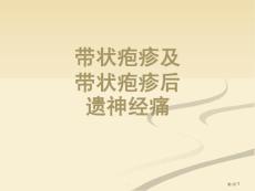 带状疱疹及带状疱疹后神经痛培训课件