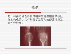 骨巨细胞瘤