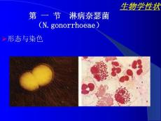 淋病奈瑟菌Ngonorrhoeae