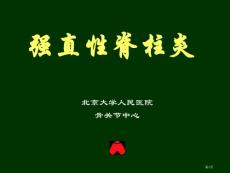 强直性脊柱炎