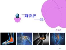 三踝骨折踝关节骨折