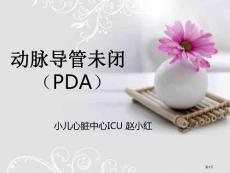 动脉导管未闭培训课件
