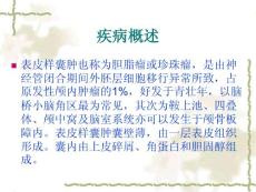 脑表皮样囊肿