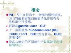 消化性溃疡pepticulcer