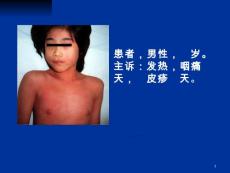 猩红热【42页】