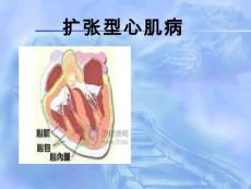 扩张型心肌病【22页】