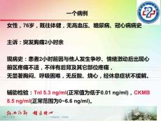 应激性心肌病