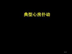 典型心房扑动培训课件培训课件