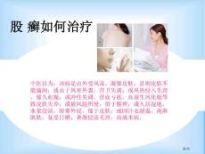 股癣如何治疗