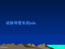 动脉导管未闭pda