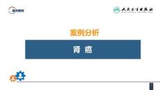 案例分析肾癌