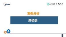 案例分析脾破裂