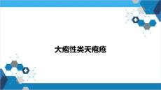 大疱性类天疱疮