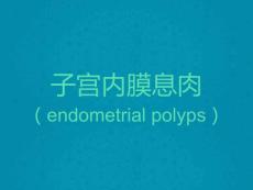 子宫内膜息肉MRI诊断