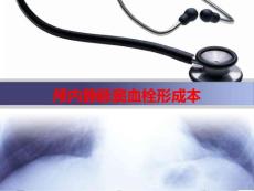 颅内静脉窦血栓形成本PPT课件