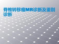 脊柱转移瘤的诊断和鉴别诊断ppt课件