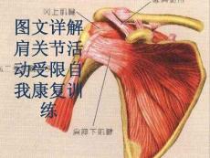 详解肩关节活动受限自我康复训练培训课件
