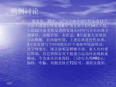 肝豆状核变性ppt课件