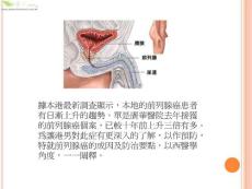 前列腺癌趋增