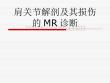 肩关节解剖及其损伤的MR诊断