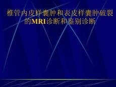 椎管内皮样囊肿和表皮样囊肿破裂的MRI诊断和鉴别诊断培训课件
