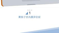 聚焦子宫内膜异位症