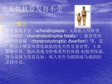 先天性软骨发育不良剖析