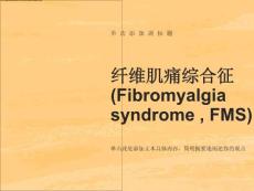 纤维肌痛综合征