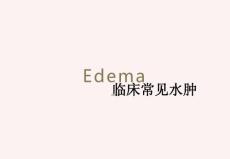 心性水肿&肾性水肿