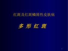 传染病多形红斑