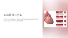 《心肌缺血、梗塞》课件
