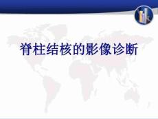 脊柱结核的影像诊断汇总.-脊柱结核典型影像