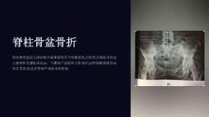 《脊柱骨盆骨折》课件