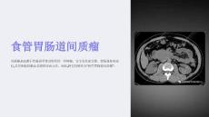 《食管胃肠道间质瘤》课件