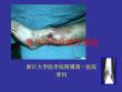 骨髓炎【34页】