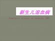 新生儿溶血病