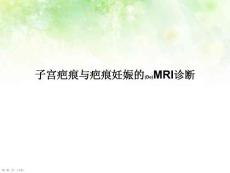 子宫疤痕与疤痕妊娠的MRI治疗教学课件ppt