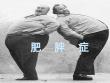 肥胖症【54页】