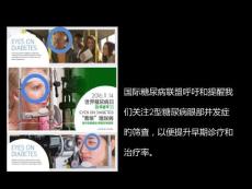 糖尿病视网膜病变