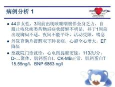 病毒性心肌炎
