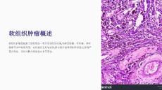 《软组织肿瘤m》课件