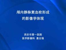 颅内静脉窦血栓形成的影像学表现