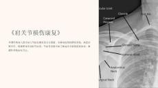 《肩关节损伤康复》课件