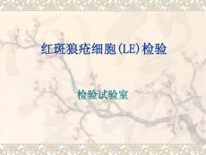 红斑狼疮检查
