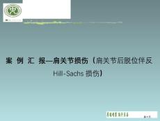 肩关节损伤肩关节后脱位伴反HillSachs损伤