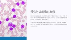 《慢性淋巴细胞白血病》课件
