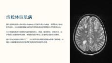 《线粒体脑肌病》课件