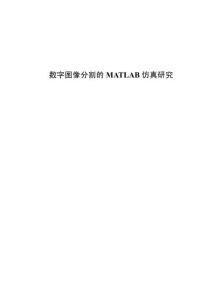 数字图像分割的MATLAB仿真研究
