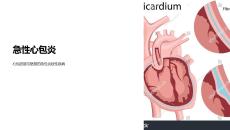 《急性心包炎》课件